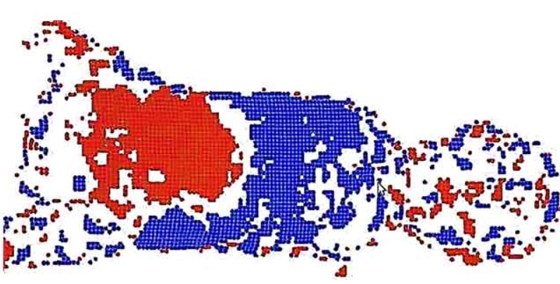 Thoraco-Abdominal Analysis